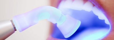 laser dentistry in farmington