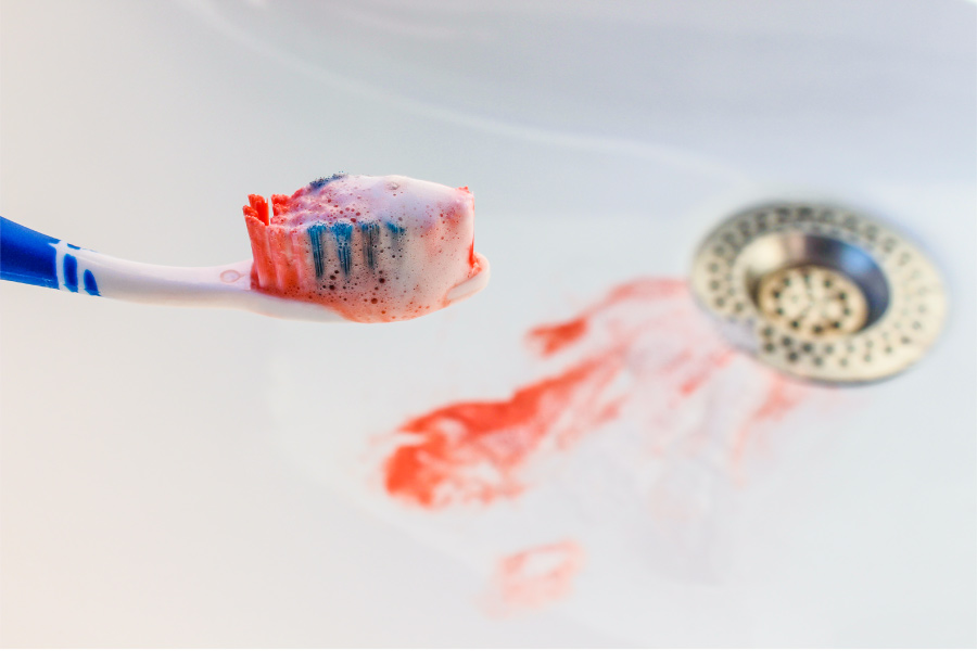 A toothbrush with blood over a sink with blood from bleeding gums due to gum disease